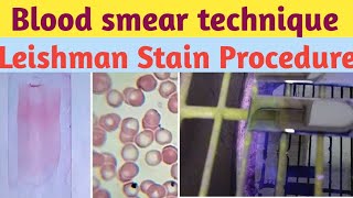 PERIPHERAL BLOOD SMEAR  HAEMATOLOGY LAB  LEISHMAN STAIN PHYSIOLOGY PRACTICALS [upl. by Mona]