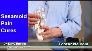 What are the Best Treatments for Sesamoiditis with Seattle Podiatrist Dr Larry Huppin [upl. by Castro]