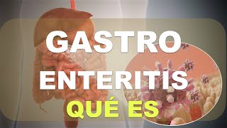 ¿Qué es la Gastroenteritis Explicación [upl. by Secilu]