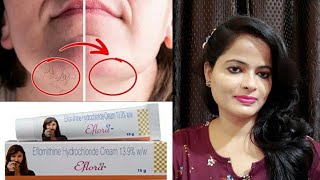 How To Use Eflora Cream  Eflora Cream Review Eflornithine Cream PraGri style [upl. by Fayola]