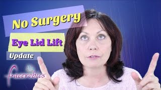 How to Get Rid of Droopy Eye Lids No Surgery Eye Lid Lift Hooded Eye Lid Lift  FACEROBICS® [upl. by Uriel]