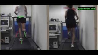 Video Gait Running Analysis Alignment Issues Rear View [upl. by Brainard633]