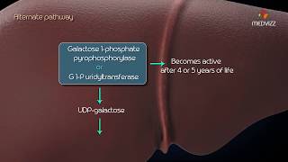 Metabolism of galactose Classic Galactosemia Galactokinase deficiency [upl. by Lockhart]