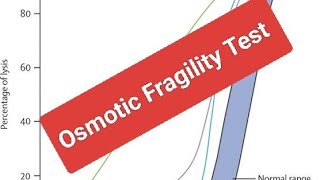 Leading Causes of Pediatric Normocytic Chronic Hemolysis HS [upl. by Edeline711]