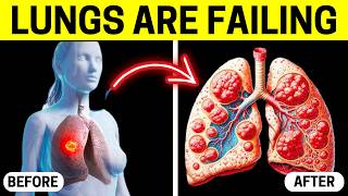 7 Signs Youve Had a Lung Infection Without Knowing [upl. by Galanti]