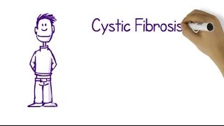 What Is Cystic Fibrosis [upl. by Tevis]