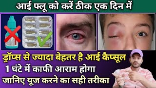 Chloramphenicol eye ointment eye capsule से करें आई फ्लू को करें ठीक [upl. by Rahs]