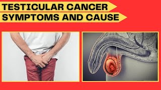 Testicular Cancer Symptoms and Causes of Testicular Cancer and Treatment Your Doctor [upl. by Ahsrop432]