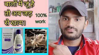 Ivrea shampu use benefits side effects full review in hindiपुरी जानकारी हिन्दी भाषा में [upl. by Nomahs544]