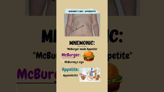 How to Perform McBurneys Test for Appendicitis  alluringlearner shorts mbbs quickrevision [upl. by Checani]