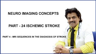 NEURO IMAGING CONCEPTS PART 24 ISCHEMIC STROKE  PART 4 [upl. by Yulma]