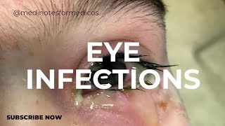 eye infections I MICROBIOLOGY I SECOND YEAR MBBSI USMLE I NEXT [upl. by Sadler]