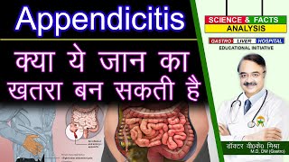 क्या ये जान का ख़तरा बन सकती है  APPENDICITIS FACTS [upl. by Kai]