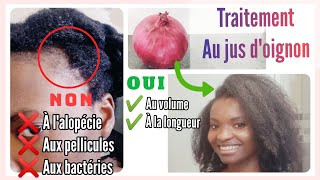 🇨🇮30• Jus doignon  poivre noir  POUSSE  Volume  ALOPÉCIE cheveux crépus afro naturels Valèh Té [upl. by Trant787]