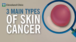 3 Types of Skin Cancer [upl. by Lebazej]