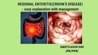 What is Crohns Disease easy explanation with management [upl. by Klinger]