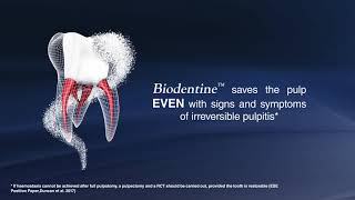 Biodentine  REVERSE THE IRREVERSIBLE [upl. by Yaja]