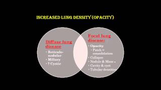 Chest X ray interpretation Part1DR AMR SAADAWY [upl. by Clein]