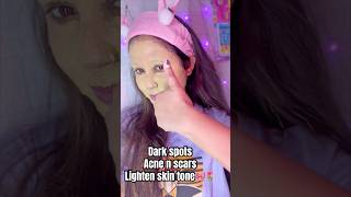 Dark spots Acne n scars Lighten skin tone🎀🌷ytshorts shorts skincare viralvideo trending [upl. by Chapin]