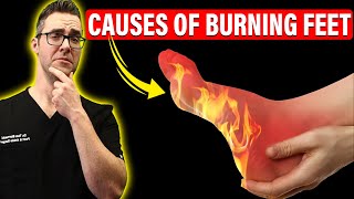 Top 11 Causes of Burning Feet amp Peripheral Neuropathy Instant FIX [upl. by Junko]