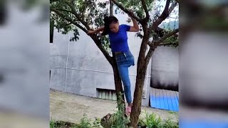 Hip Amputee Girl On Tree Top  One Leg Woman  Hip Disarticulation [upl. by Ahsak472]