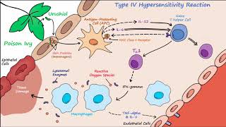 Type IV Hypersensitivity Described Concisely [upl. by Lichtenfeld]