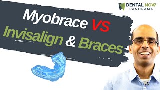 Myobrace compared to Braces and Invisalign  Dentist Explained 2021 [upl. by Anilave]