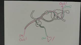 Neuroanatomy  Visceral Referred Pain [upl. by Fredia]