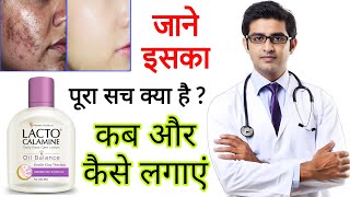 Lacto Calamine face lotion HONEST Review 2024 in hindi  Results Benefits Uses Price Information [upl. by Ahsilat]