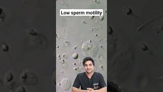 Low Sperm Motility  Slow sperms dont reach egg maleinfertilitytreatment IVF ICSI [upl. by Trauner]