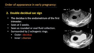 Ultrasound of normal early pregnancy [upl. by Joellyn713]