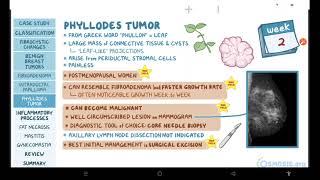 Benign breast conditions  pathology review  Osmosis [upl. by Nolham]