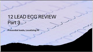 12 Lead ECG Review Part 3 Localizing MI [upl. by Suivatnom]