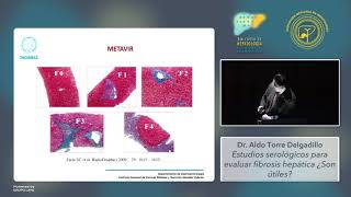 Módulo I Estudios serológicos para evaluar fibrosis hepática ¿Son útiles [upl. by Lamonica]