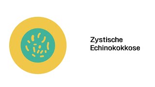 Zystische Echinokokkose  Infektionskrankheiten [upl. by Sidhu]