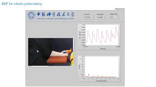 New robotic finger mimics human touch for medical diagnostics [upl. by Ennoitna]