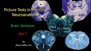 Picture Test in Neuroanatomy Brain Sections 7 [upl. by Severen122]