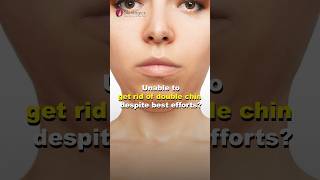 Get rid of Double Chin  Best Dermatologist in Noida  Skinlogics Clinic [upl. by Brittani]