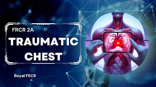 17  Chest Imaging for FRCR [upl. by Hauser]