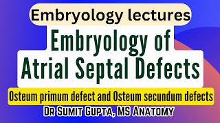 Atrial Septal Defects  Embryological basis [upl. by Nami78]