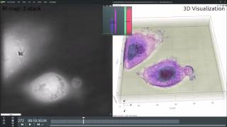 Living Tcell killing a living cancer cell [upl. by Gregorio]