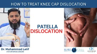 How to treat knee cap dislocation Patella Dislocation  Dr Latif [upl. by Ddahc]