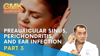 Preauricular Sinus Perichondritis and Ear Infection Part 3  Usapang Pangkalusugan [upl. by Trutko789]