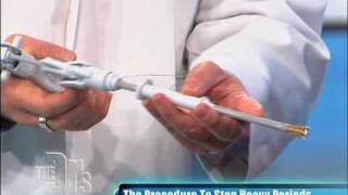 Novasure Procedure Performed on The Doctors [upl. by Edgell]