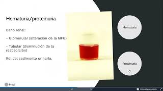 UT10  Hematuria proteinuria [upl. by Collar629]