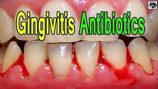 Gingivitis Antibiotics  What is the Best ANTIBIOTIC for Gingivitis [upl. by Omer]