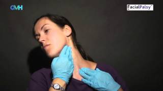 Facial Palsy DVD 2  Management of Synkinesis  Stretches for the Tight Side [upl. by Ginger]