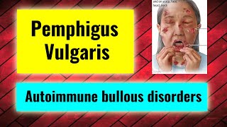 Pemphigus vulgaris overview treatment management Autoimmune bullous diseases part 2 [upl. by Ev]