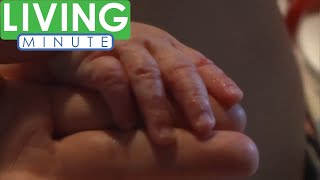 Is Hand Foot and Mouth Disease Contagious to Adults  Living Minute [upl. by Noedig]