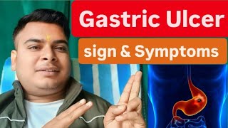 Gastric Ulcer in hindi  Ulcer sign and symptoms and treatment [upl. by Eltsyrhc263]